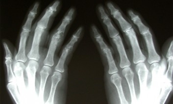Clinical Signs and Radiographs of Patients with Rheumatological Disorders