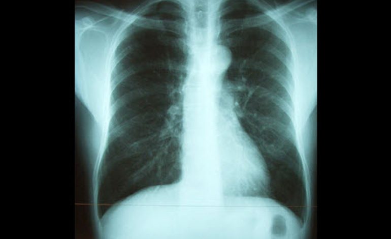 The CXR Gallery