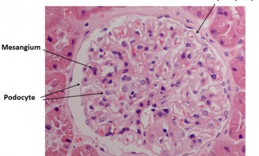 Normal Glomerulus