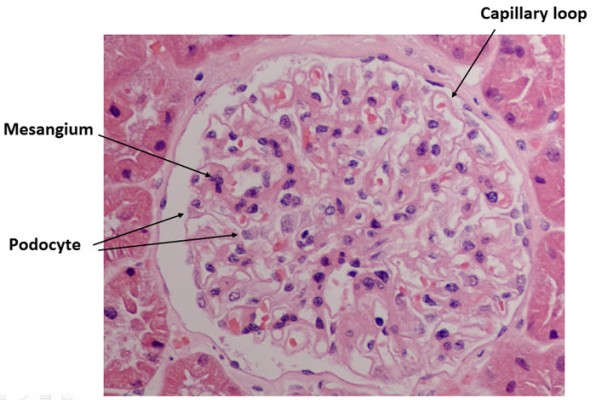 Normal Glomerulus The HKU E learning Platform In Clinical Medicine 